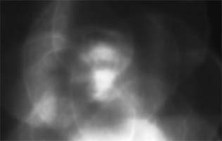 Thumbnail Placeholder